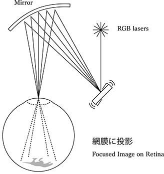 Illustrated material: Retina projection technology